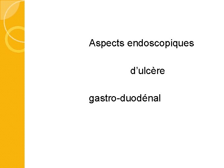 Aspects endoscopiques d’ulcère gastro-duodénal 