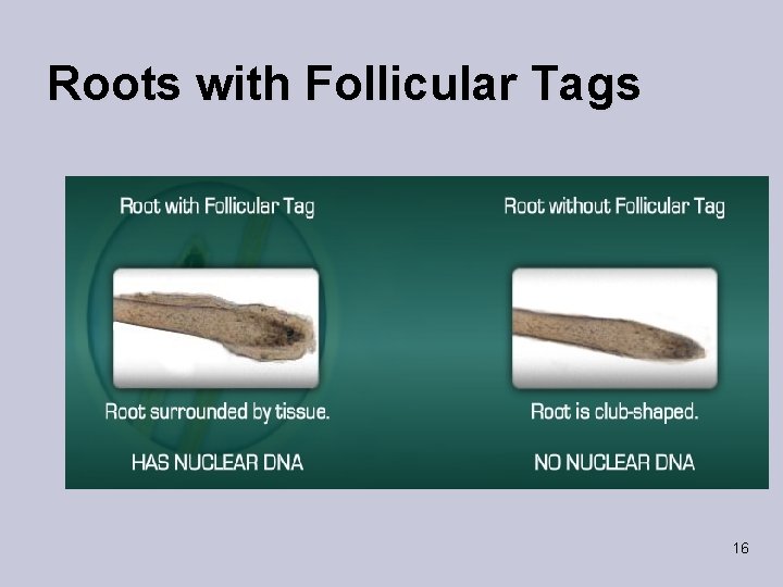 Roots with Follicular Tags 16 