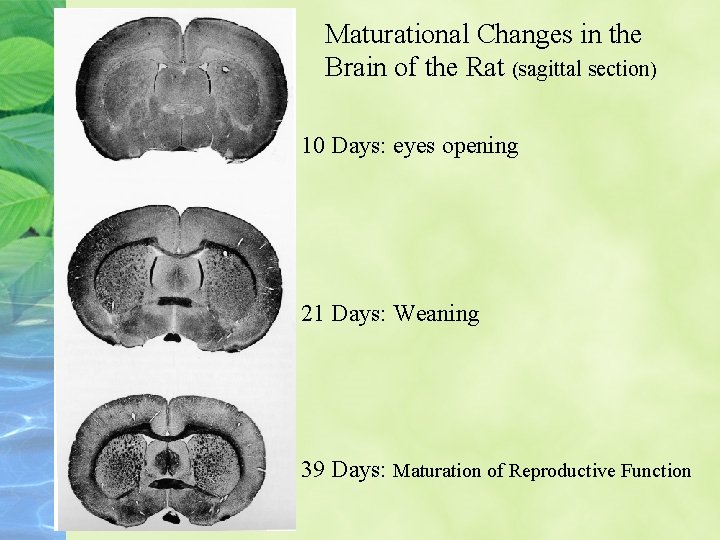 Maturational Changes in the Brain of the Rat (sagittal section) 10 Days: eyes opening