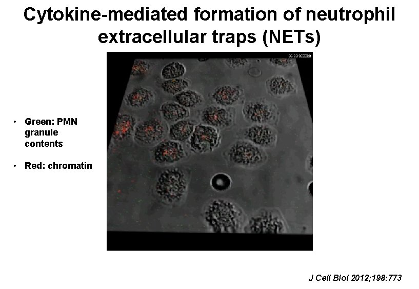 Cytokine-mediated formation of neutrophil extracellular traps (NETs) • Green: PMN granule contents • Red: