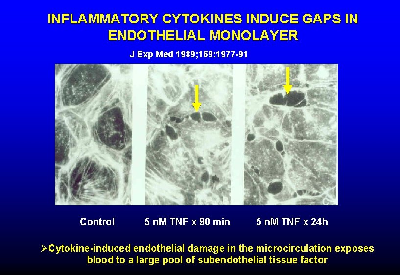 INFLAMMATORY CYTOKINES INDUCE GAPS IN ENDOTHELIAL MONOLAYER J Exp Med 1989; 169: 1977 -91