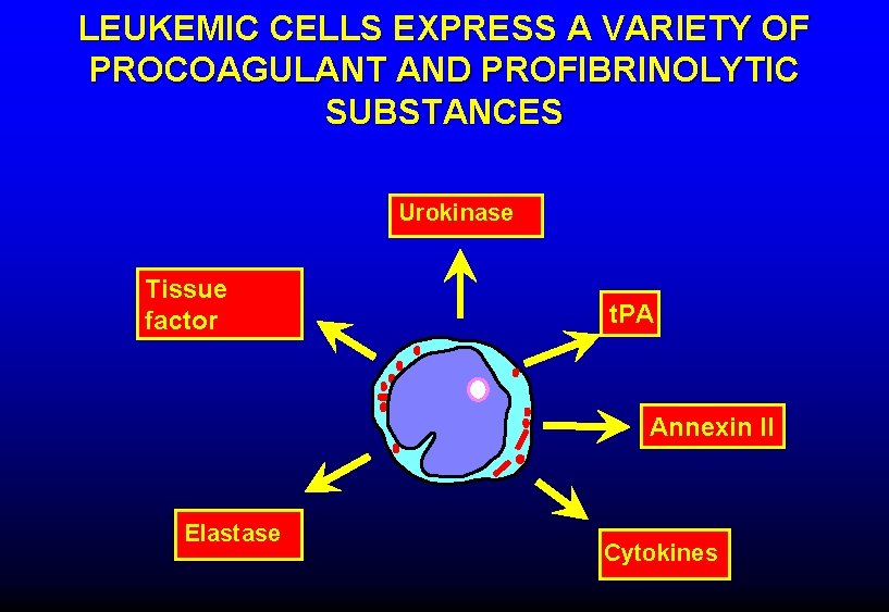 LEUKEMIC CELLS EXPRESS A VARIETY OF PROCOAGULANT AND PROFIBRINOLYTIC SUBSTANCES Urokinase Tissue factor t.