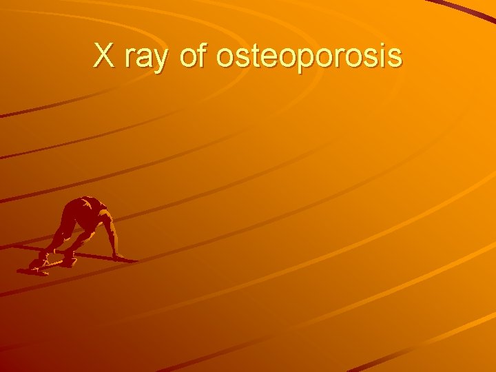 X ray of osteoporosis 