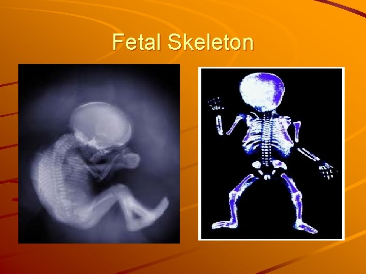 Fetal Skeleton 