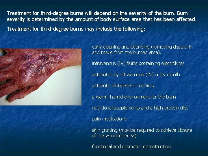 Treatment for third-degree burns will depend on the severity of the burn. Burn severity