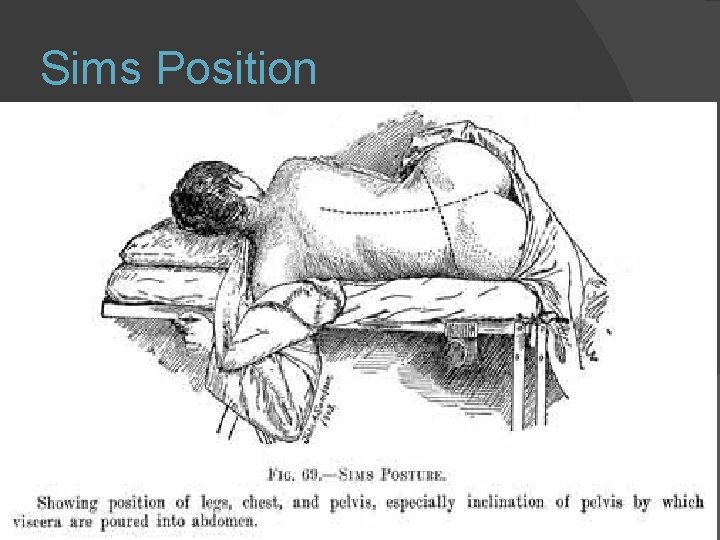 Sims Position 