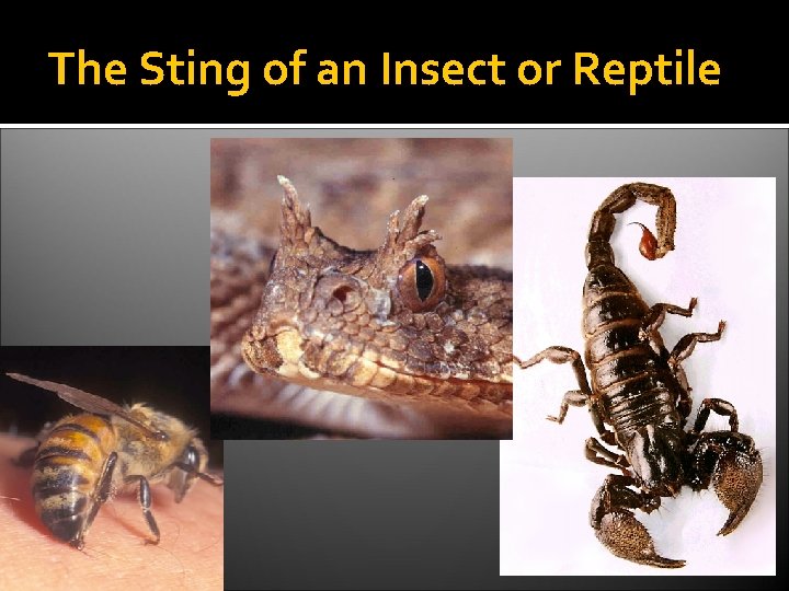 The Sting of an Insect or Reptile 