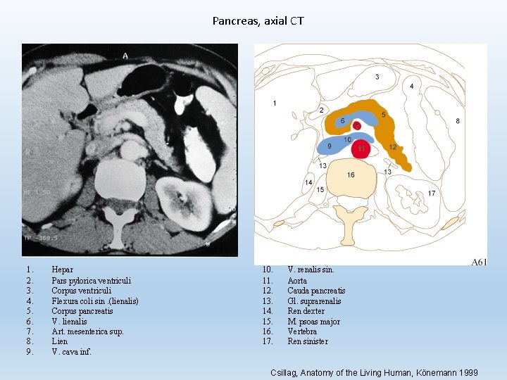 Pancreas, axial CT 1. 2. 3. 4. 5. 6. 7. 8. 9. Hepar Pars