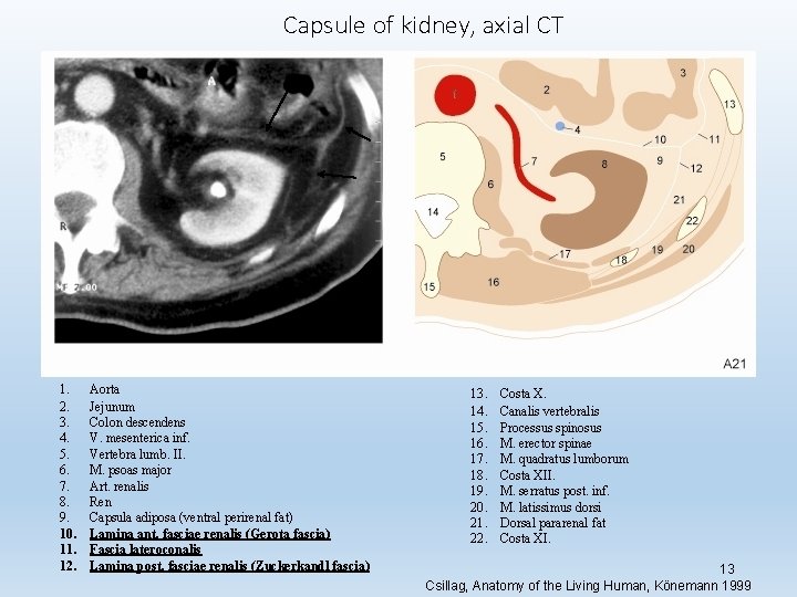 Capsule of kidney, axial CT 1. 2. 3. 4. 5. 6. 7. 8. 9.