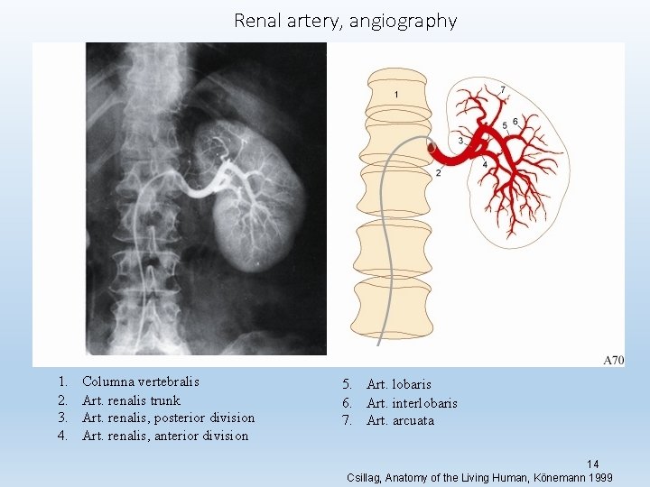 Renal artery, angiography 1. 2. 3. 4. Columna vertebralis Art. renalis trunk Art. renalis,
