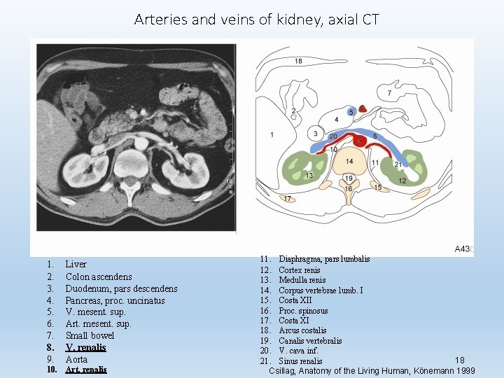 Arteries and veins of kidney, axial CT 1. 2. 3. 4. 5. 6. 7.