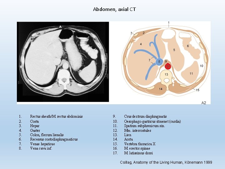 Abdomen, axial CT 1. 2. 3. 4. 5. 6. 7. 8. Rectus sheath/M. rectus