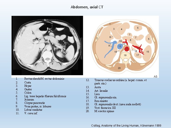 Abdomen, axial CT 1. 2. 3. 4. 5. 6. 7. 8. 9. 10. 11.