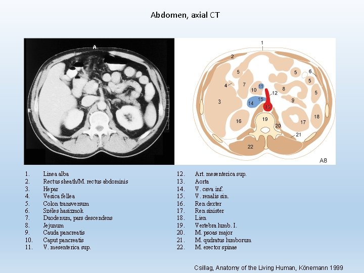 Abdomen, axial CT 1. 2. 3. 4. 5. 6. 7. 8. 9. 10. 11.