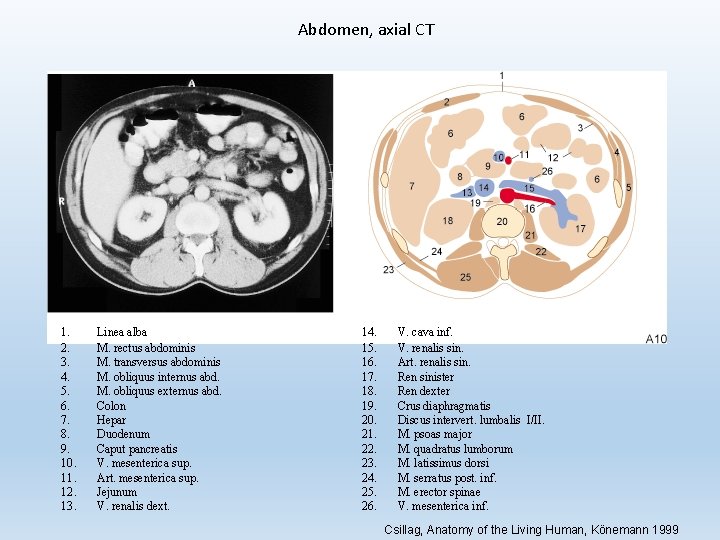 Abdomen, axial CT 1. 2. 3. 4. 5. 6. 7. 8. 9. 10. 11.