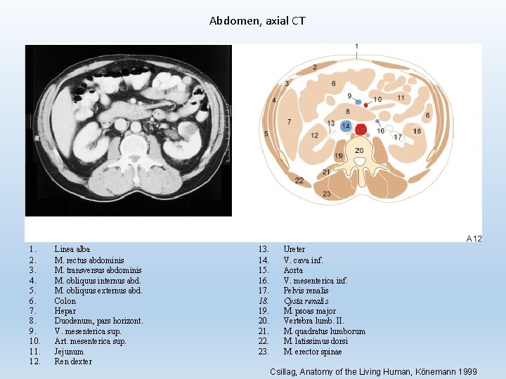 Abdomen, axial CT 1. 2. 3. 4. 5. 6. 7. 8. 9. 10. 11.