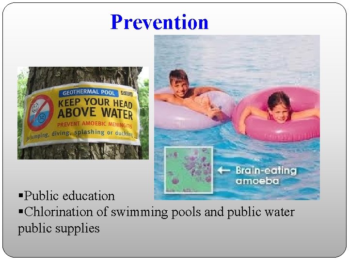 Prevention §Public education §Chlorination of swimming pools and public water public supplies 