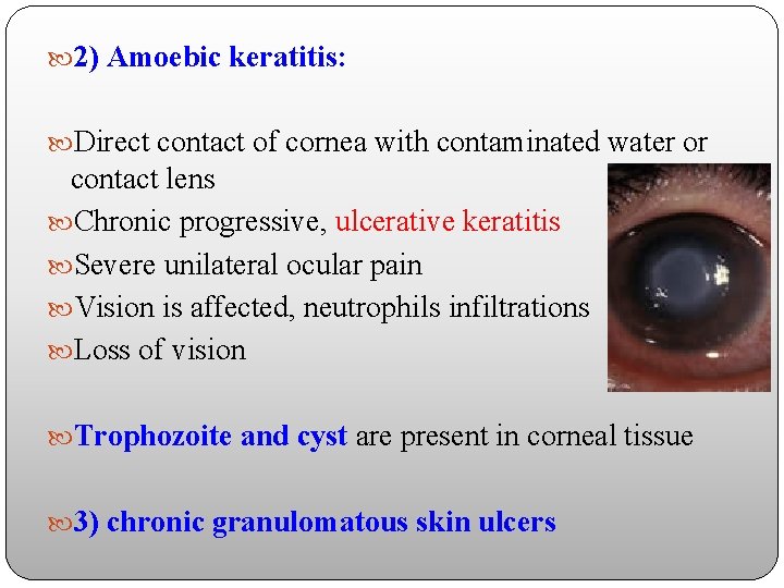  2) Amoebic keratitis: Direct contact of cornea with contaminated water or contact lens