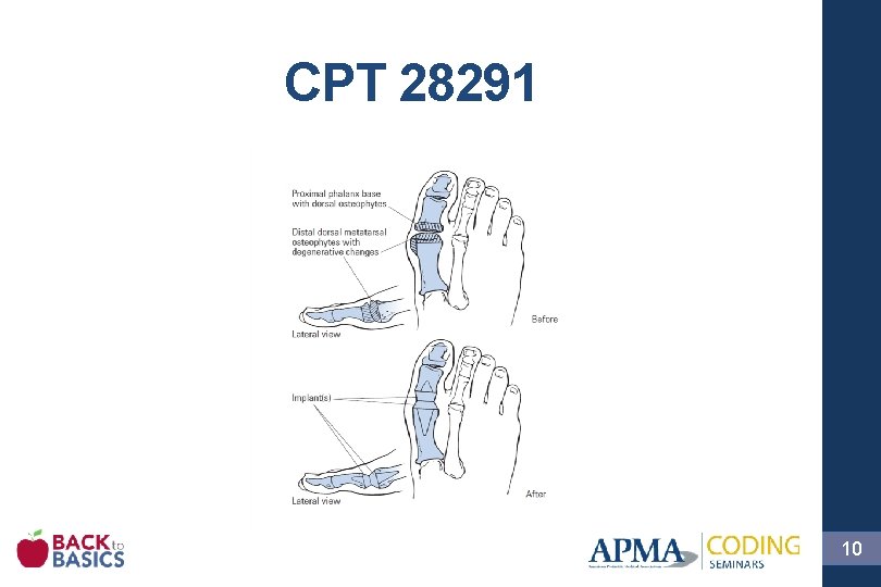 CPT 28291 10 
