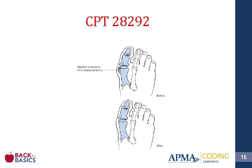 CPT 28292 16 