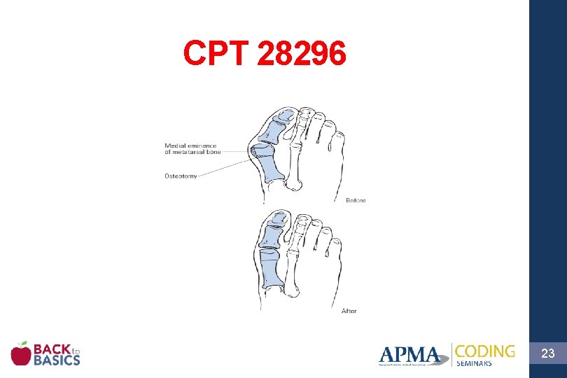 CPT 28296 23 