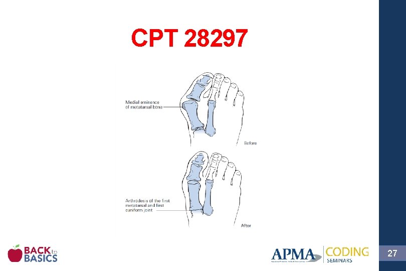 CPT 28297 27 