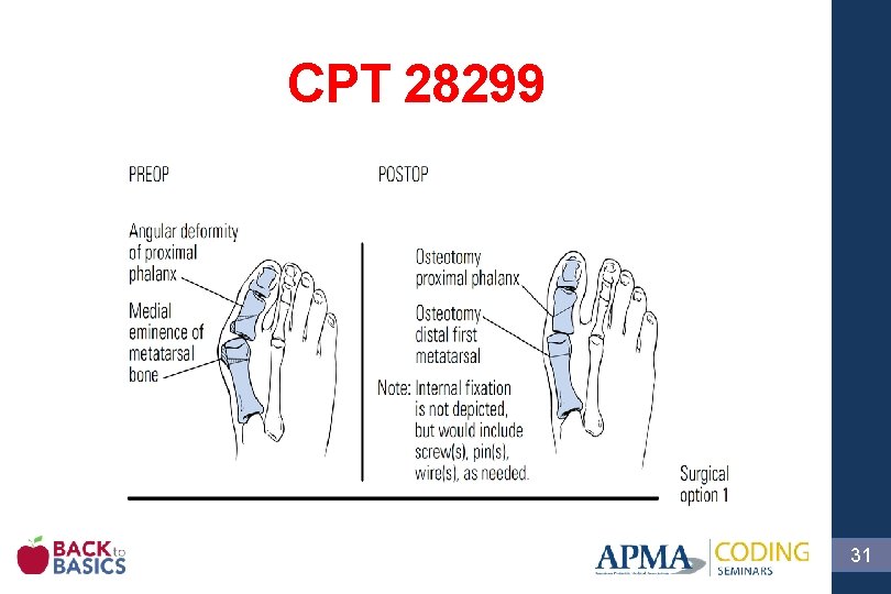 CPT 28299 31 