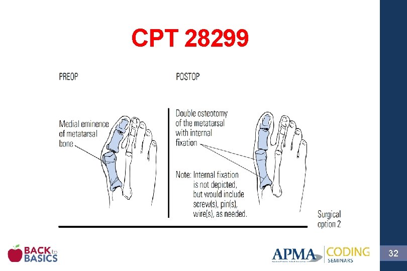 CPT 28299 32 