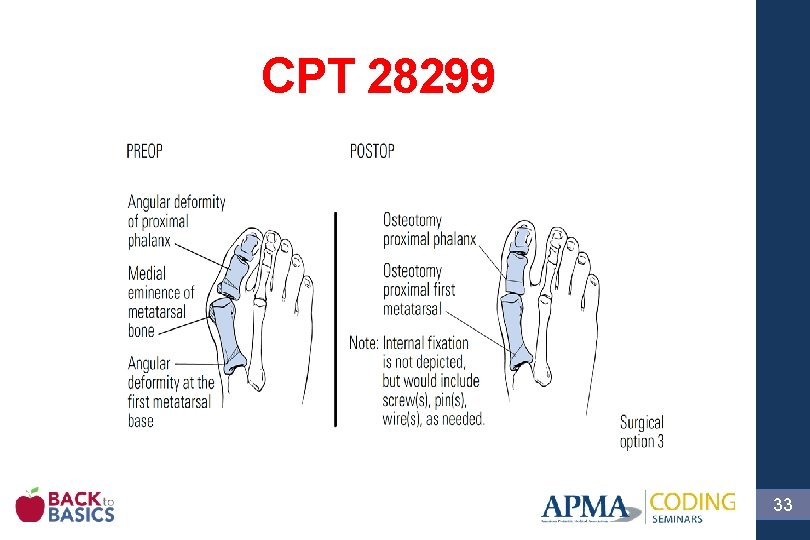 CPT 28299 33 