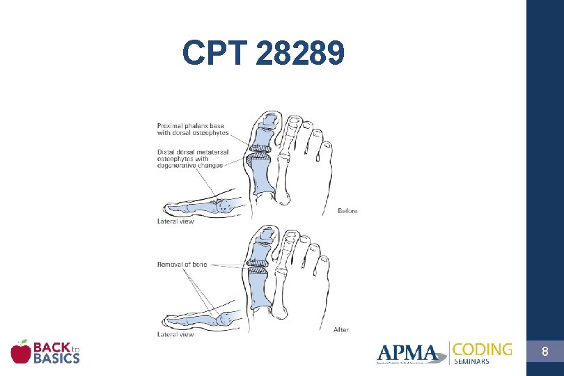 CPT 28289 8 