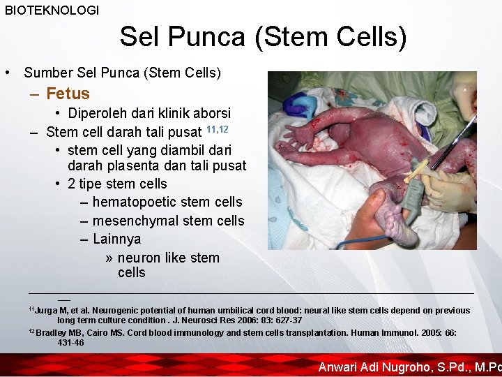 BIOTEKNOLOGI Sel Punca (Stem Cells) • Sumber Sel Punca (Stem Cells) – Fetus •