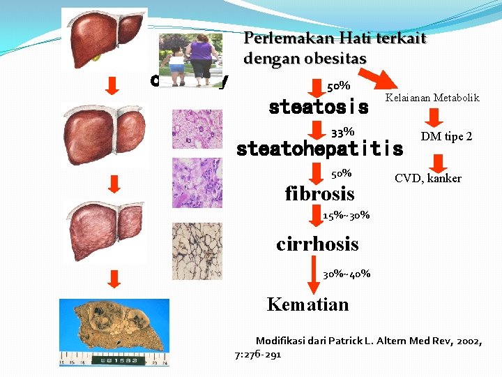 obesity Perlemakan Hati terkait dengan obesitas 50% steatosis 33% Kelaianan Metabolik steatohepatitis 50% fibrosis