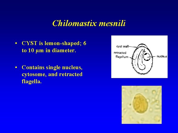 Chilomastix mesnili • CYST is lemon-shaped; 6 to 10 µm in diameter. • Contains