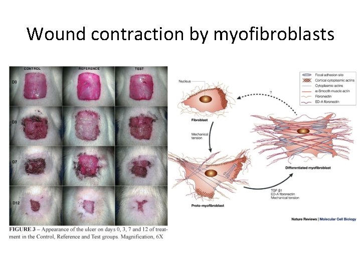 Wound contraction by myofibroblasts 