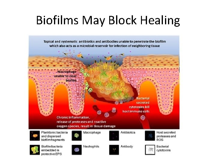 Biofilms May Block Healing 