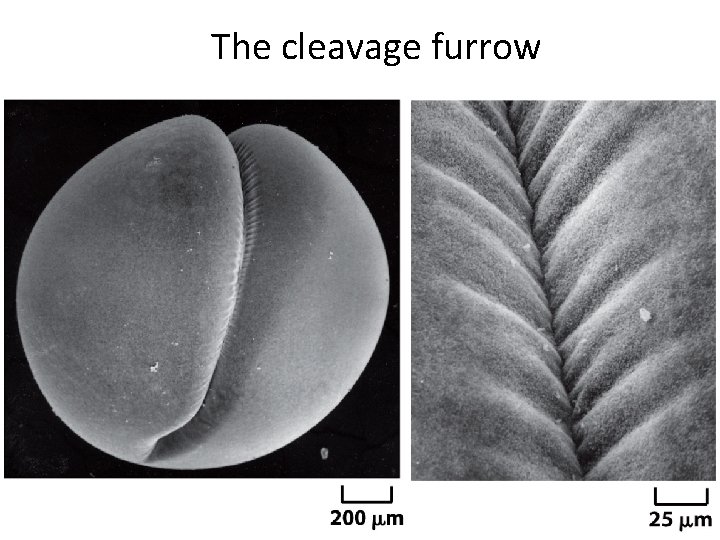 The cleavage furrow 