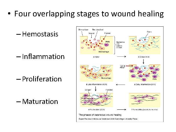  • Four overlapping stages to wound healing – Hemostasis – Inflammation – Proliferation