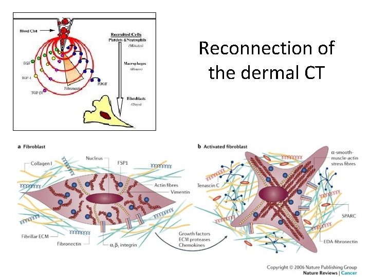 Reconnection of the dermal CT 