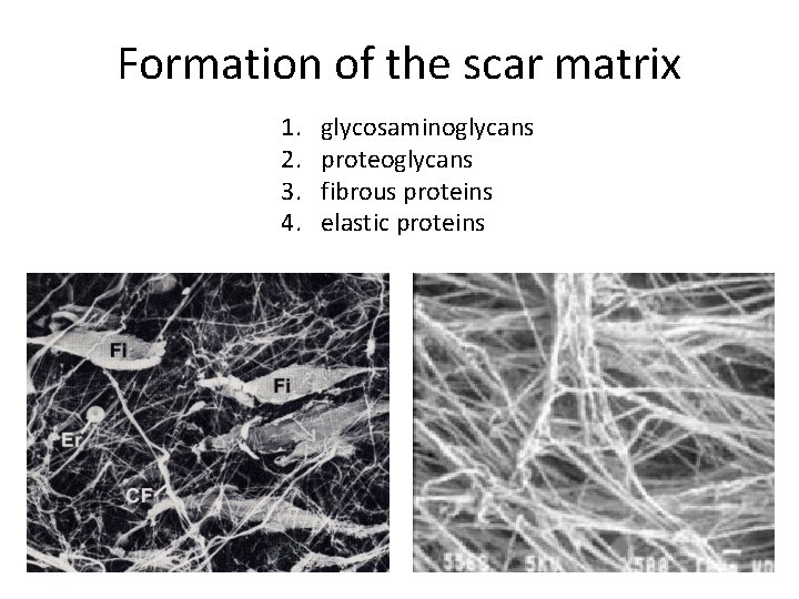 Formation of the scar matrix 1. 2. 3. 4. glycosaminoglycans proteoglycans fibrous proteins elastic
