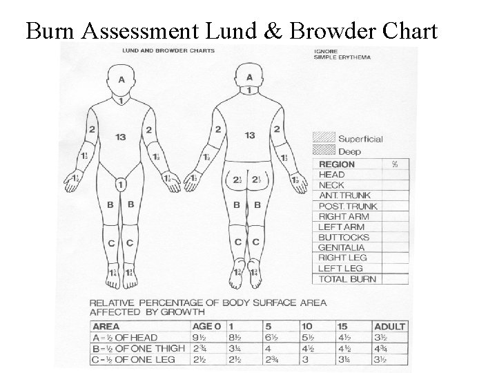 Burn Assessment Lund & Browder Chart 