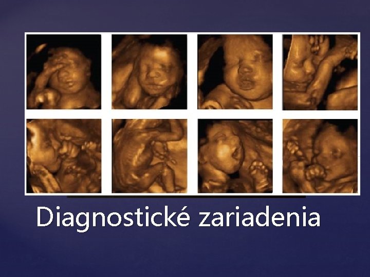  Klasické diagnostické zariadenia Spracovávajú údaje Kvalitné výstupy (papierová alebo elektronická podoba) Röntgenová technika,