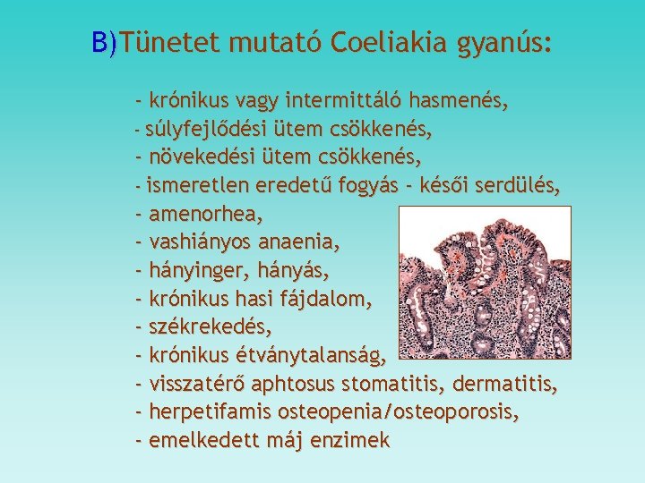 B)Tünetet mutató Coeliakia gyanús: - krónikus vagy intermittáló hasmenés, - súlyfejlődési ütem csökkenés, -