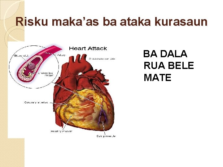 Risku maka’as ba ataka kurasaun BA DALA RUA BELE MATE 