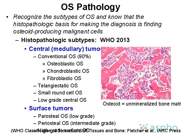 OS Pathology • Recognize the subtypes of OS and know that the histopathologic basis