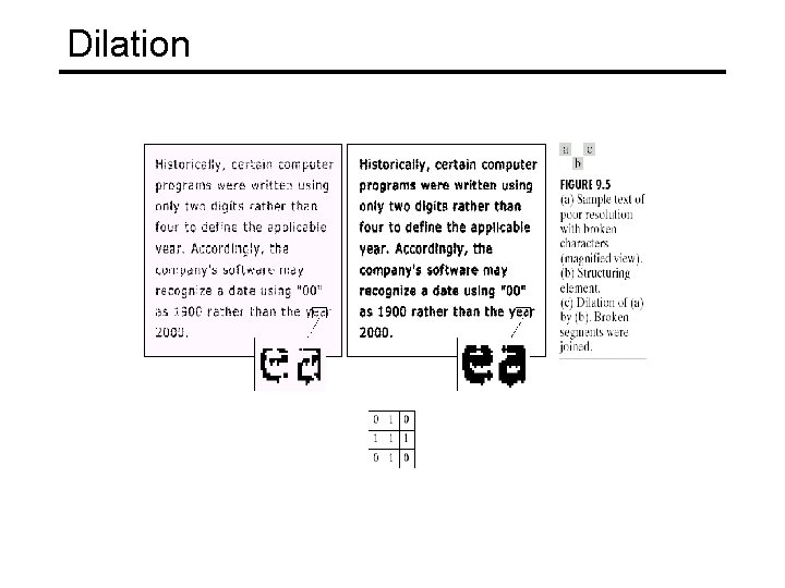 Dilation 