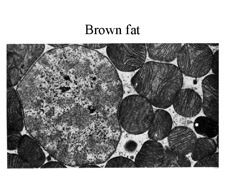 Brown fat 