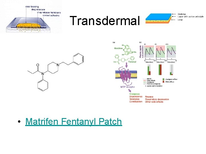 Transdermal • Matrifen Fentanyl Patch 