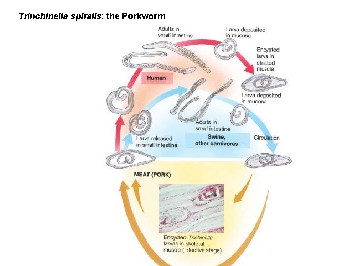 Trinchinella spiralis: the Porkworm Figure 11. 13 (a) 
