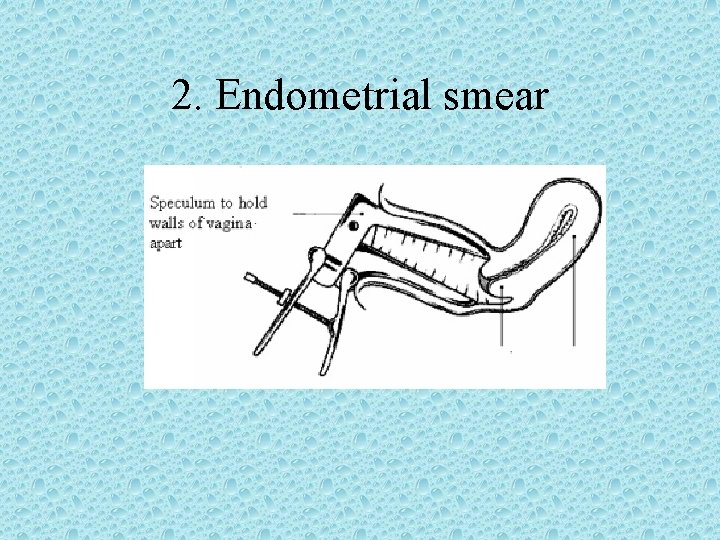 2. Endometrial smear 