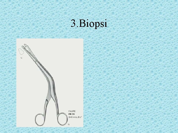 3. Biopsi 